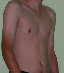 Why Men Have Nipples