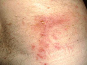 Seen Bites Like These?