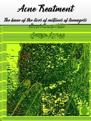 Acne-Eng-TW-hires Acne Treatment book cover