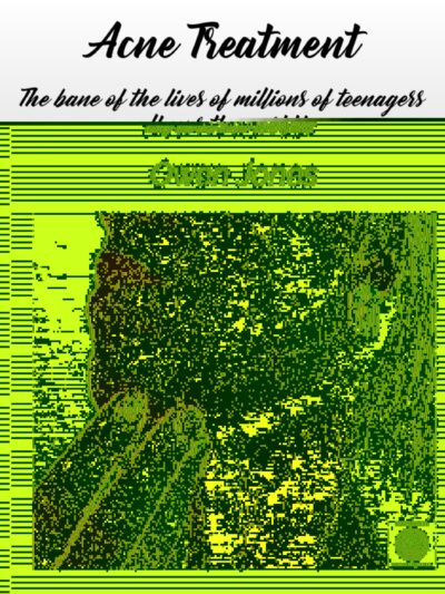 Acne-Eng-TW-hires Acne Treatment book cover