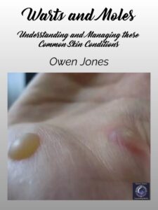 Warts and Moles 3 Warts and Moles book cover